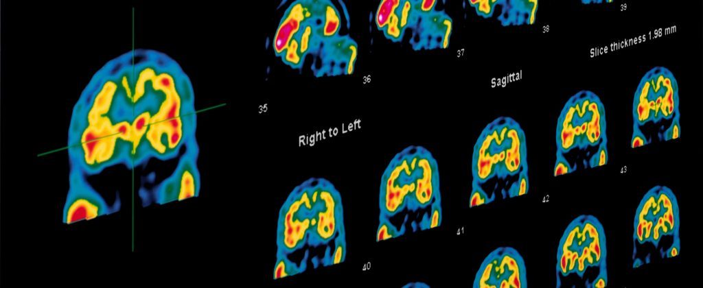 Nuclear / SPECT CT | Eisenhower Imaging Center