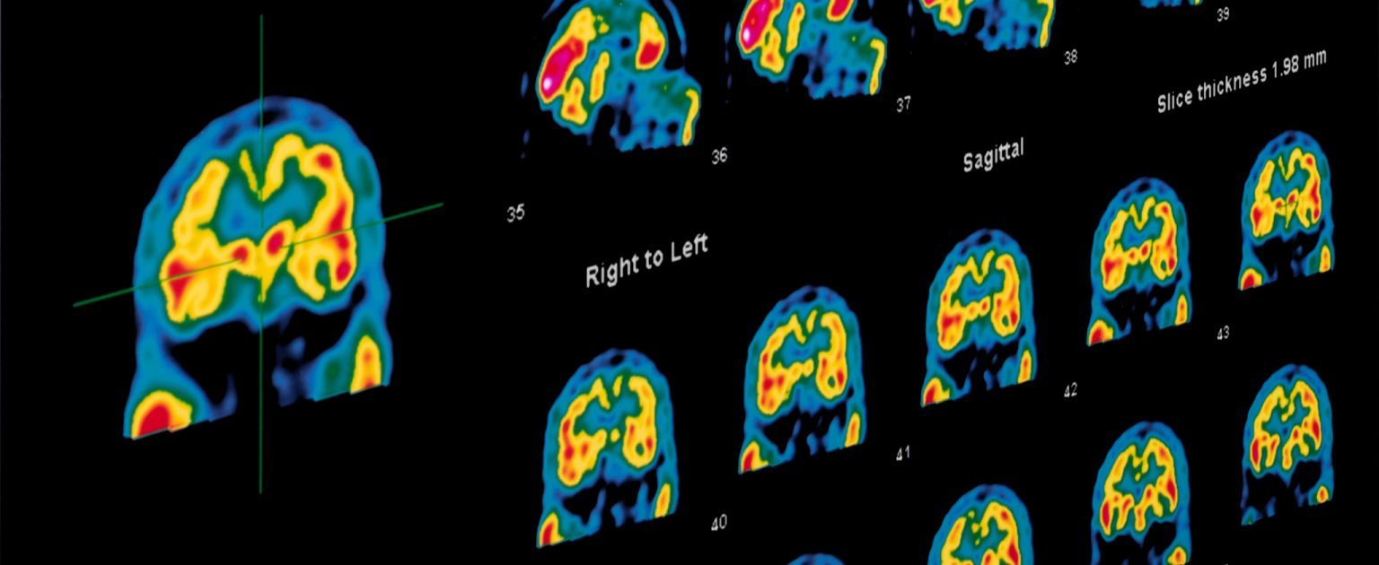 Nuclear / SPECT CT | Eisenhower Imaging Center